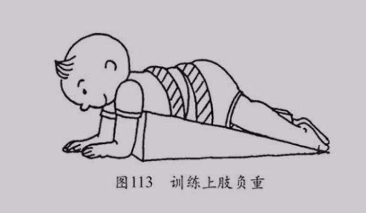 促进抬头和增加头控力:患儿取俯卧位对称姿势,双上肢搭在楔形垫的
